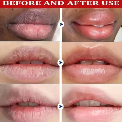 5x Nicotinamide Remove Dark Lip Balm Anti Cracking Gloss Powder Lip Mask Exfoliating Moisturizing Lipstick  Reduce Lip Lines ﻿