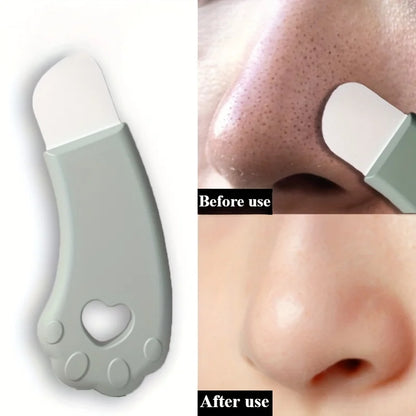 New Cat's Paw Blackhead Removal Tool - Perfect for Removing Pimples and Blemishes, Gentle Pore Cleansing, Exfoliating, Easy to H